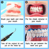 Luckin Smile textura-suave-gel facilita retirada sin irritación