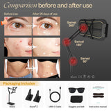 LuxRenew Max: gafas incluidas para protección ocular durante la sesión