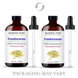 Majestic Pure Aceite de Incienso con cuentagotas para aromaterapia en casa.