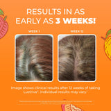 MaryRuth's Biotín líquido 10000 mcg, vitamina clave para cabello y energía