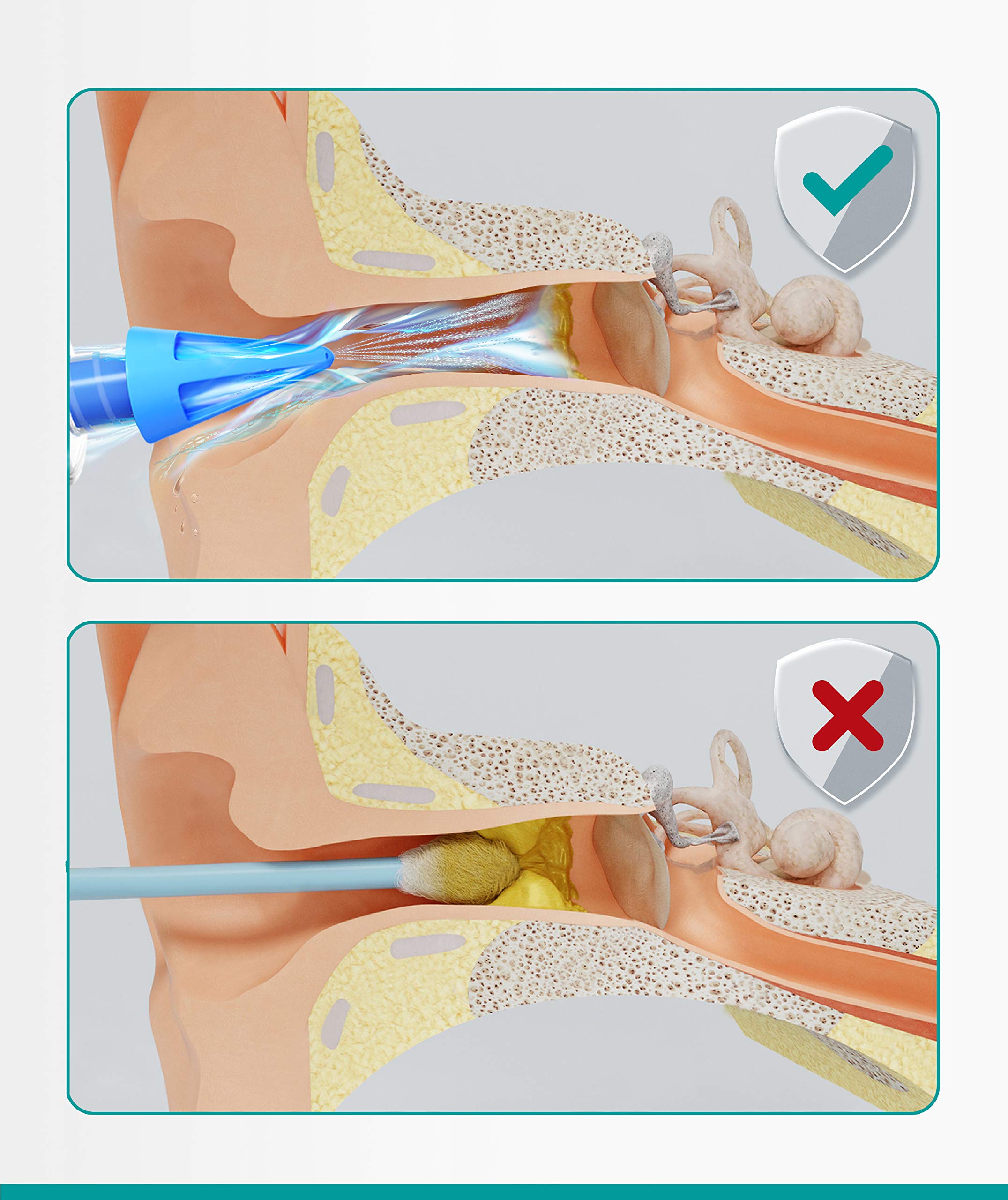 Medi Grade: kit reutilizable para higiene auricular confiable