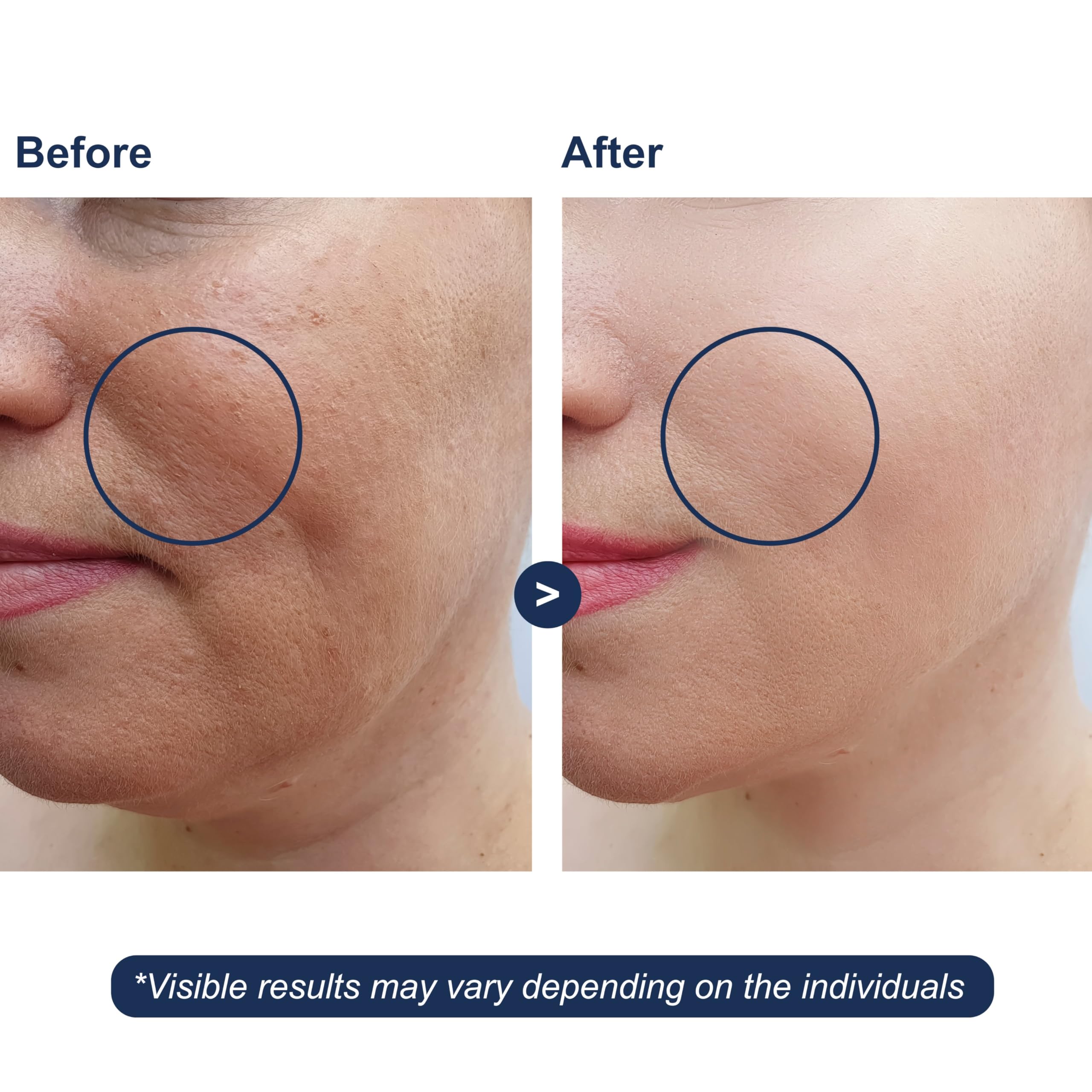 Micro Ingredients Serum hialuronico textura ligera y absorción rápida.