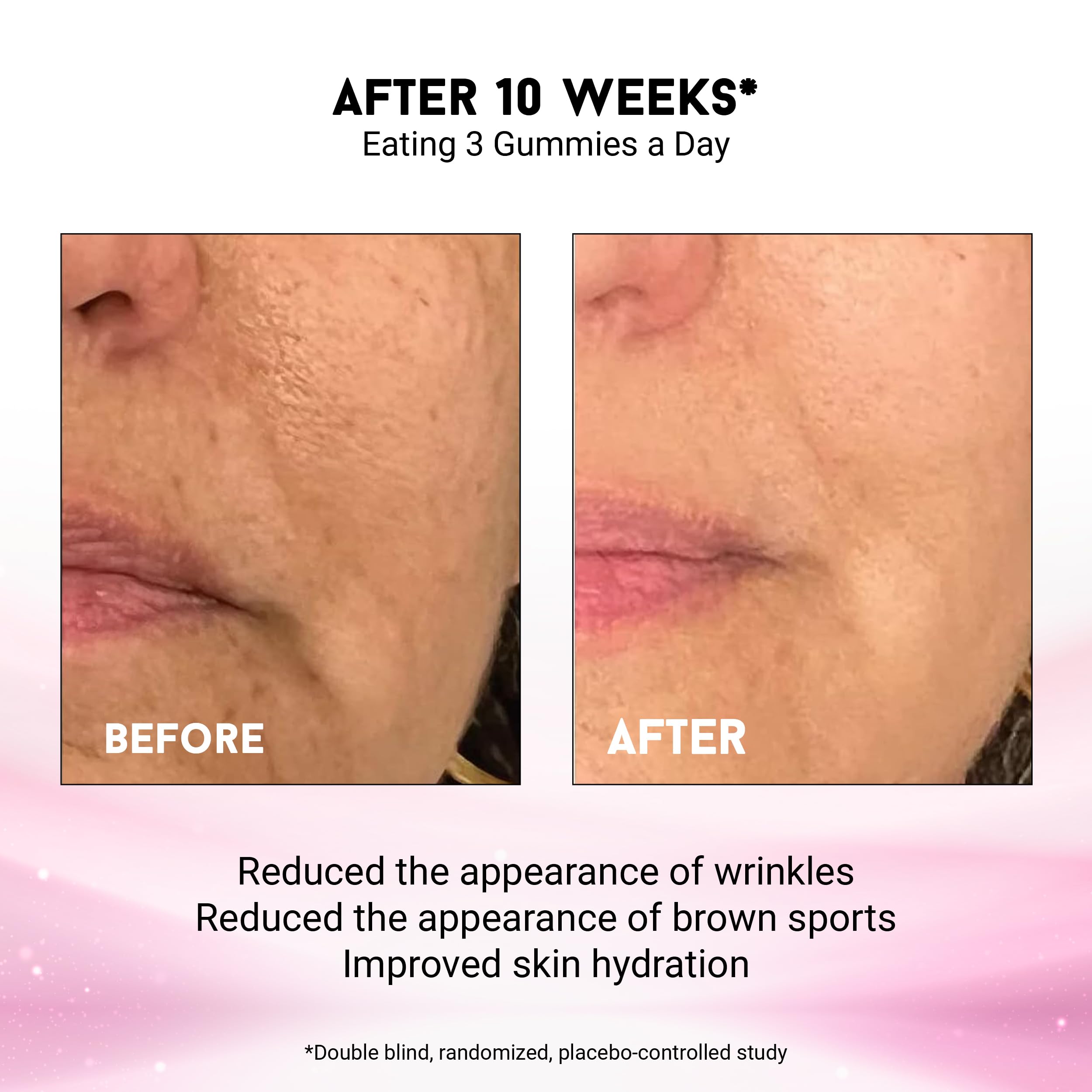 Gominolas Miracle Elixir Collection fortalecen la barrera cutánea