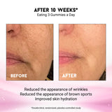 Gominolas Miracle Elixir Collection fortalecen la barrera cutánea
