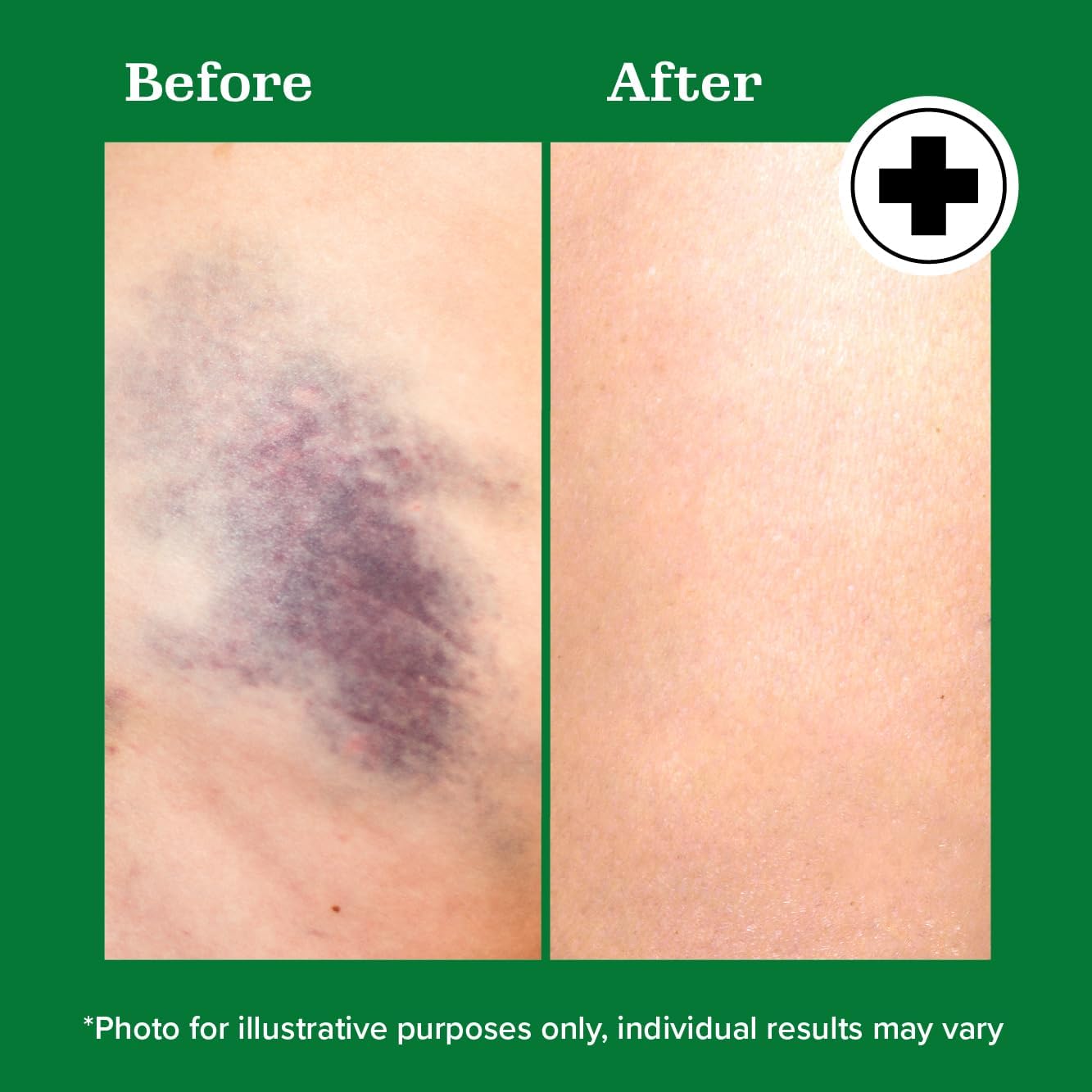 Miracle Plus frasco de 4 onzas líquidas de gel arnica para uso tópico