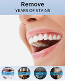 MySmile bandeja dental lista para sesiones de blanqueado en casa