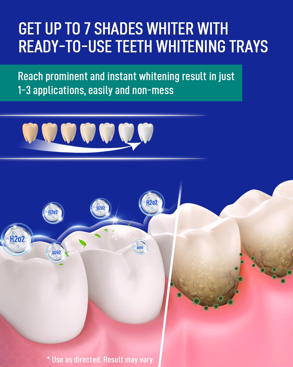 MySmile conjunto de blanqueamiento dental para uso casero