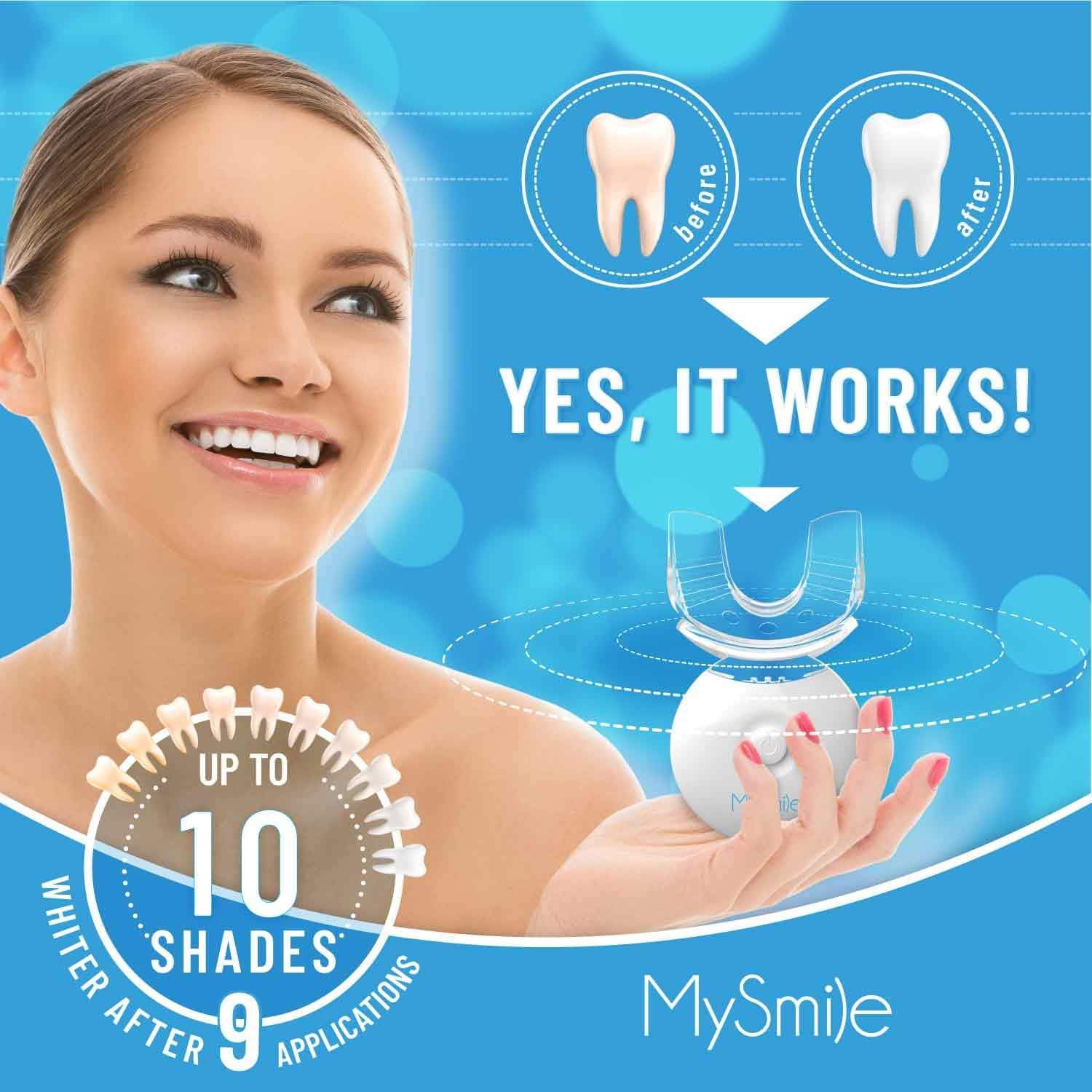 MySmile gel blanqueador al 35% de peróxido de carbamida para manchas difíciles