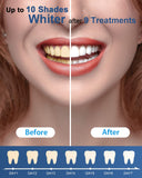 MySmile sonrisa más blanca tras cada uso, con poco esfuerzo