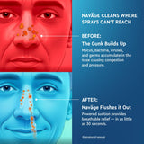 Navage cápsulas salinas: solución rápida para un lavado nasal cómodo.