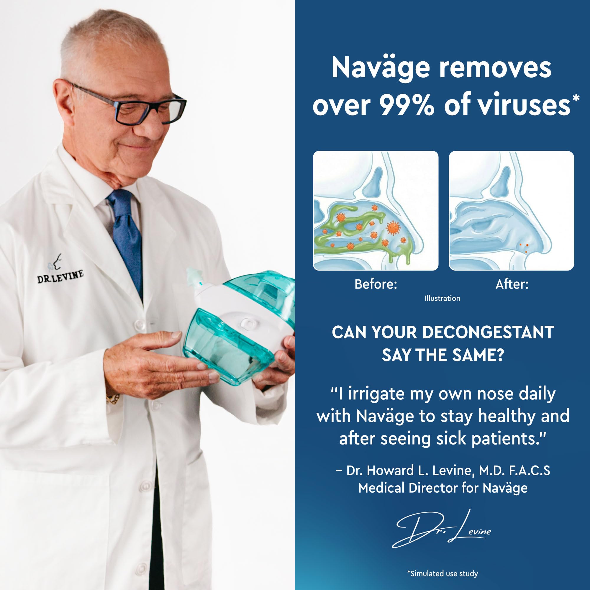 Navage: dos soportes para nariz para un sellado cómodo