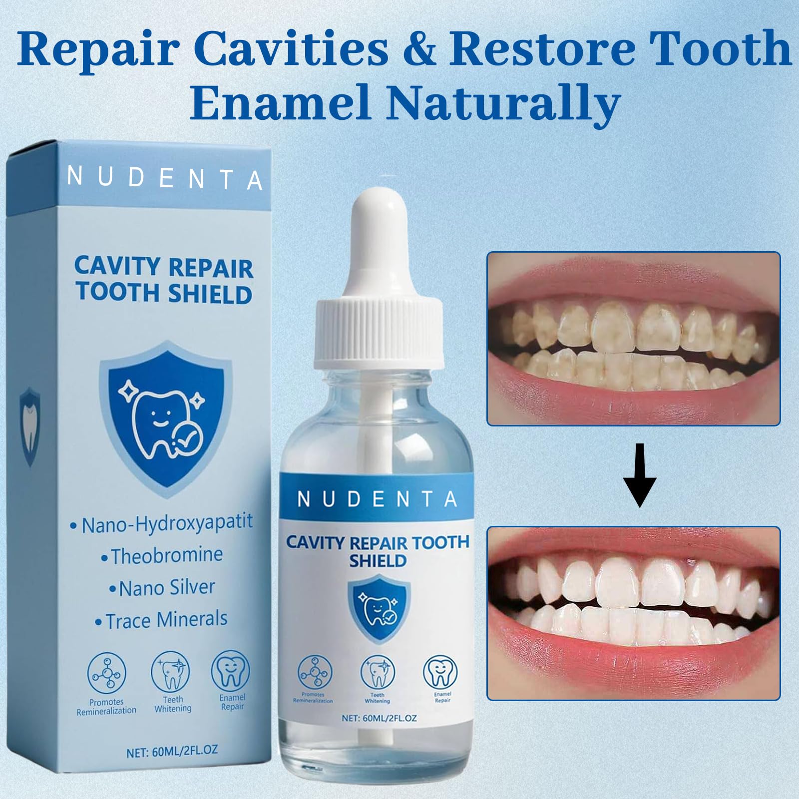 NUDENTA Odontic Repair: aplicación diaria en dientes para cuidado en casa.