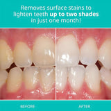 Opalescence pasta dental elimina manchas superficiales para tono más claro.