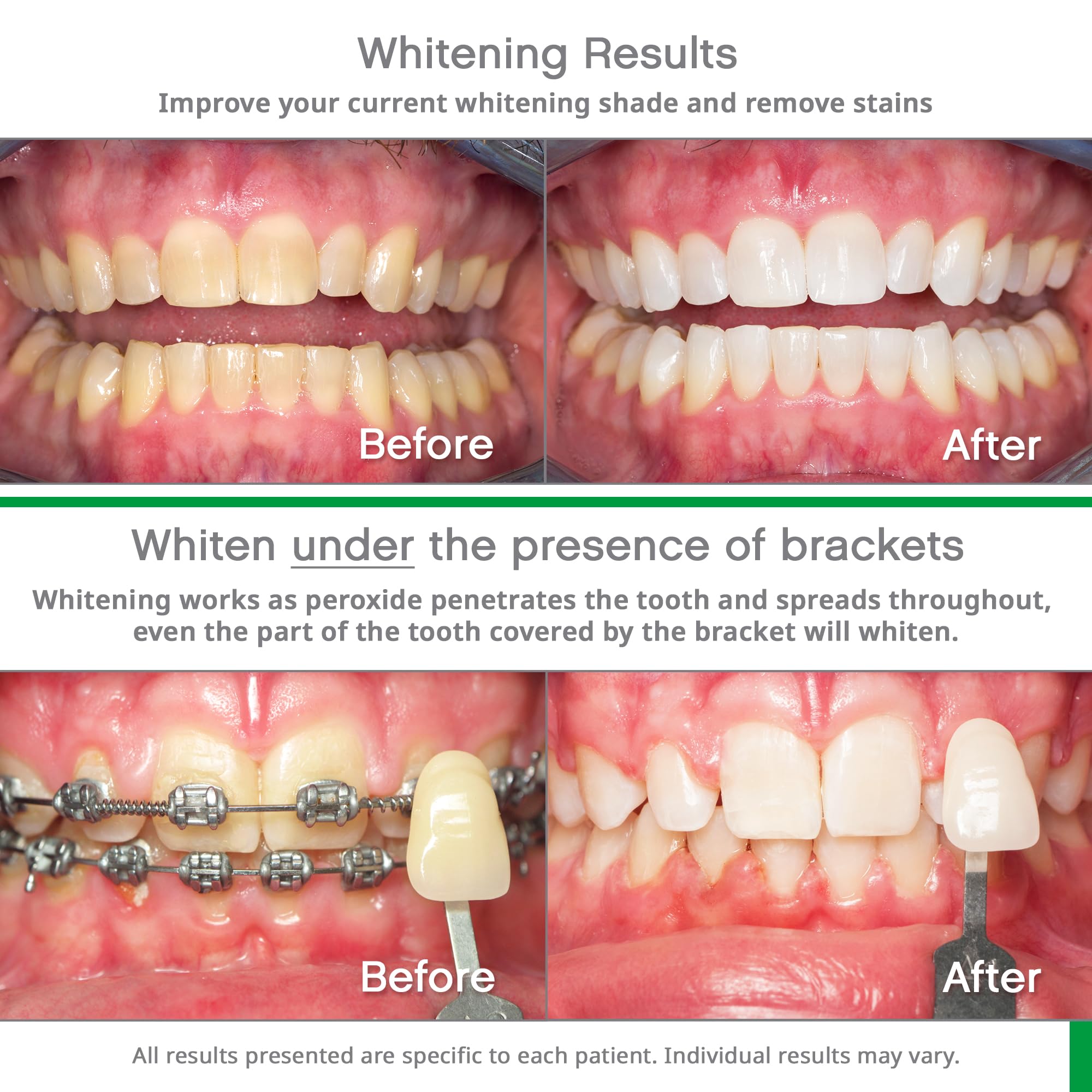 Opalescence para mantenimiento: pasta dental para conservar los resultados.