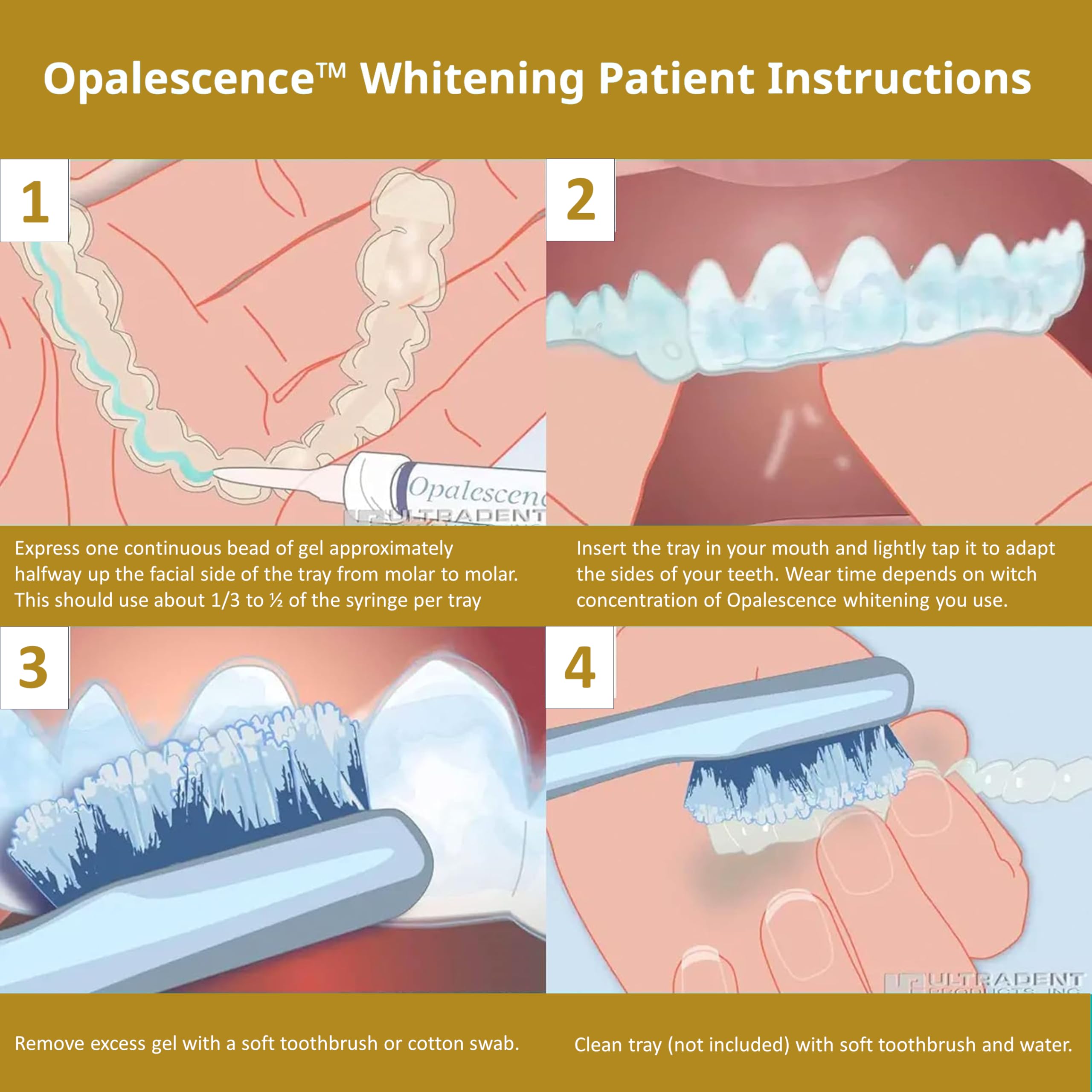 Opalescence sabor menta para una experiencia fresca