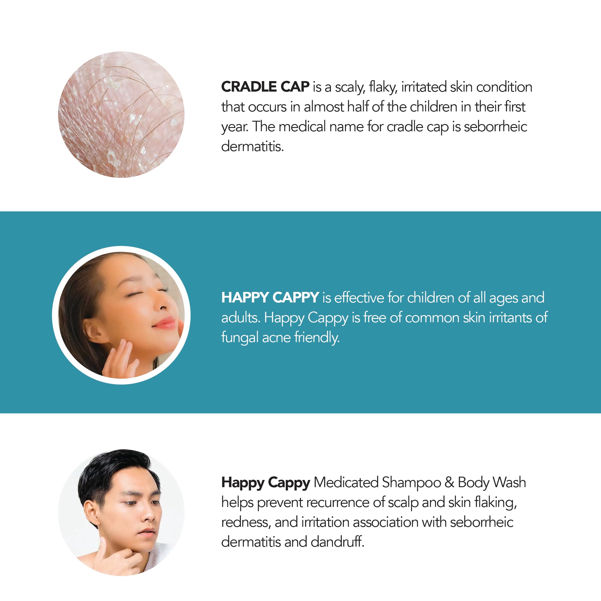 Pack de tres Happy Cappy champú medicado para uso familiar