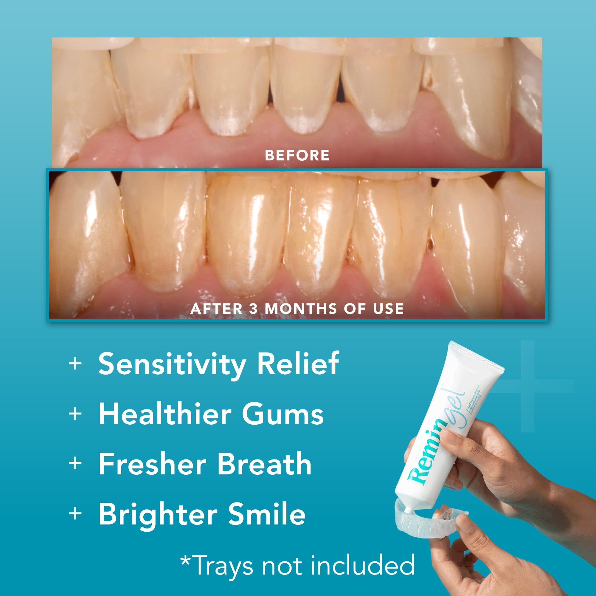 ReminGel de Perio Protect: hidroxiapatita mineral clave para fortalecer el esmalte.