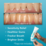 ReminGel de Perio Protect: hidroxiapatita mineral clave para fortalecer el esmalte.