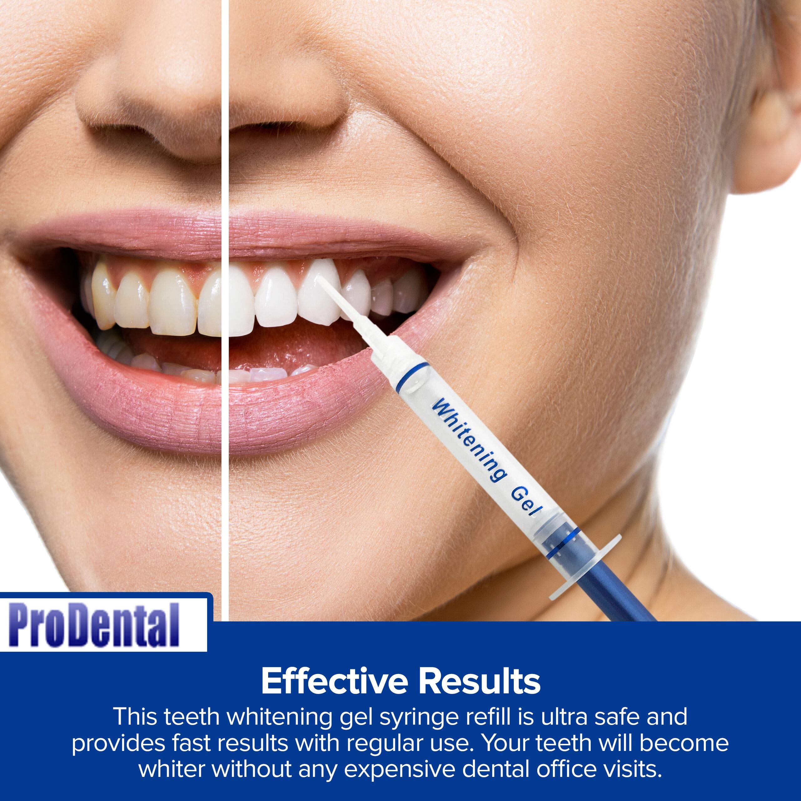 ProDental sonrisa brillante para uso diario y confianza