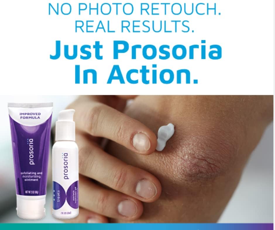 Prosoria aplicación diaria: rutina simple para piel sensible