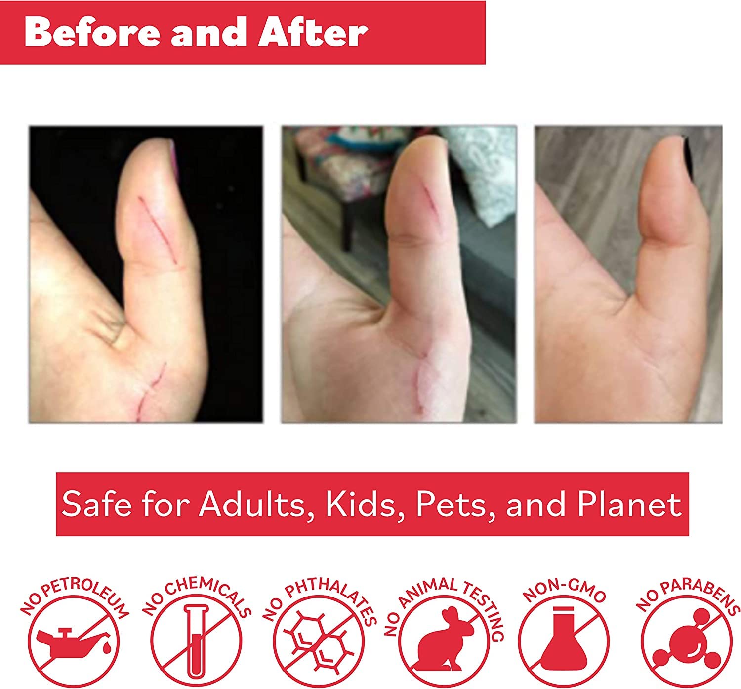 Aplicación en heridas superficiales con Puremedy, opción natural.