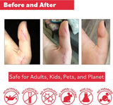 Aplicación en heridas superficiales con Puremedy, opción natural.