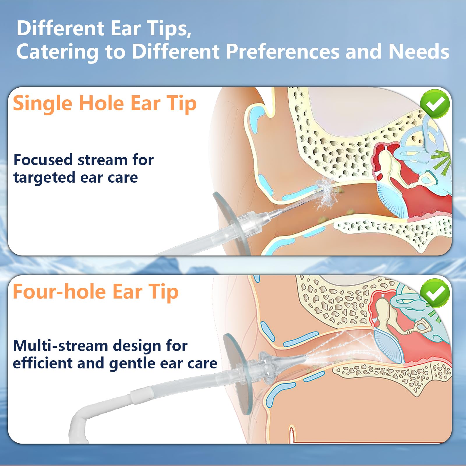 QISXROVY conjunto de curetas para retirar cerumen con control