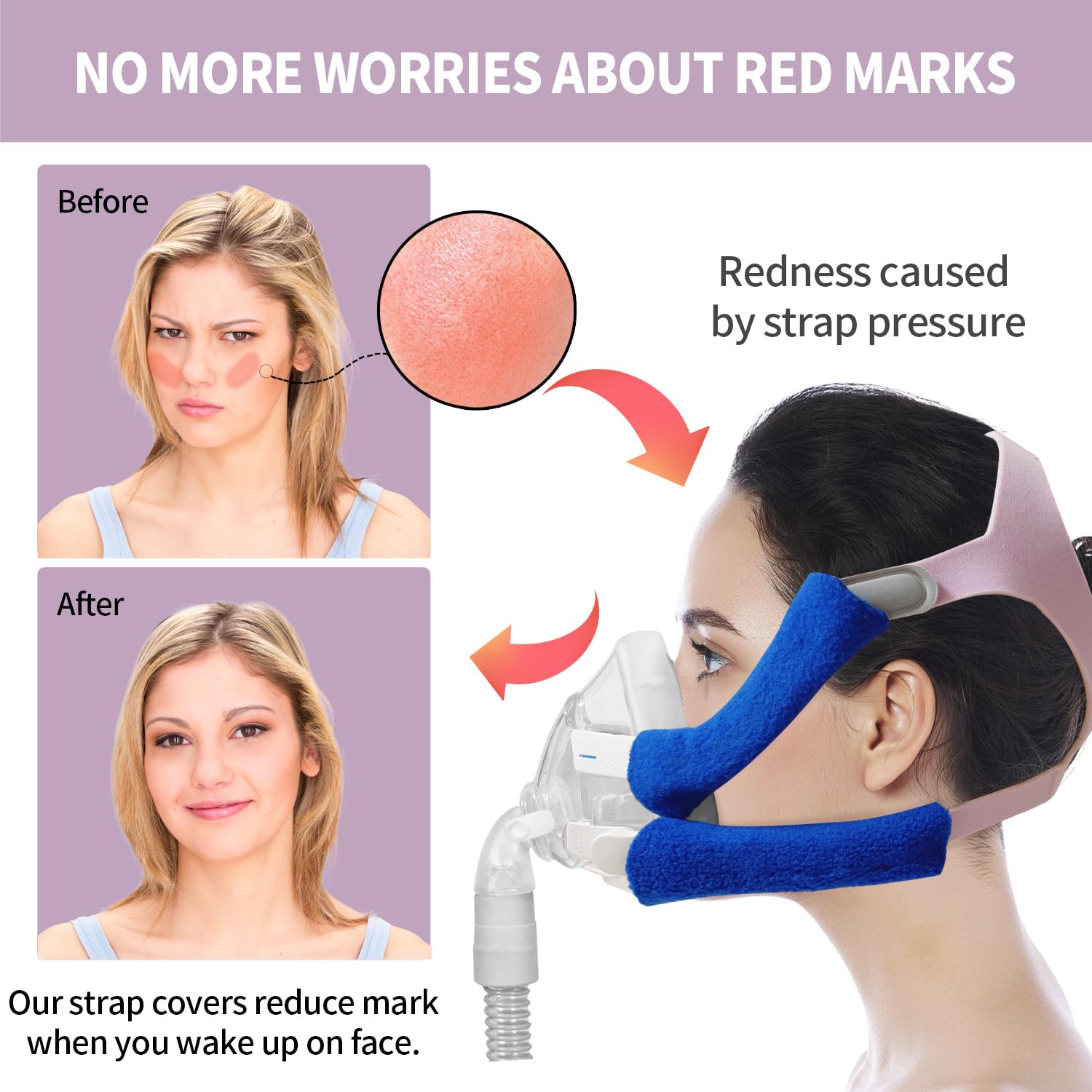 Rescare F20 compatible con mascaras F20 para mejor ajuste