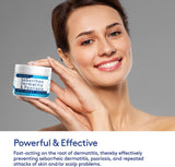 Roycederm crema seborreica cuero cabelludo reduce escamas