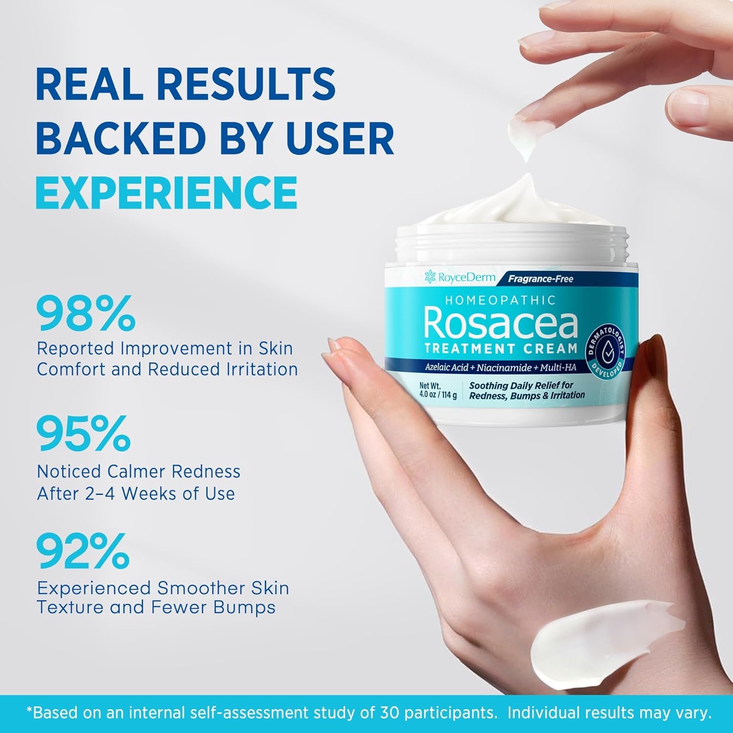 Roycederm Rosacea: ceramidas para reparar la barrera y mantener la hidratación