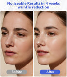 Rupuqira LED infrarroja para cuerpo, relajación y alivio de tensiones