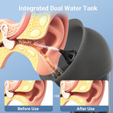 ScopeAround sistema de tanque integrado, separación de agua limpia y residual.