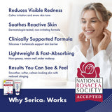Serica crema rosácea: aplicación diaria para piel más cómoda y balanceada
