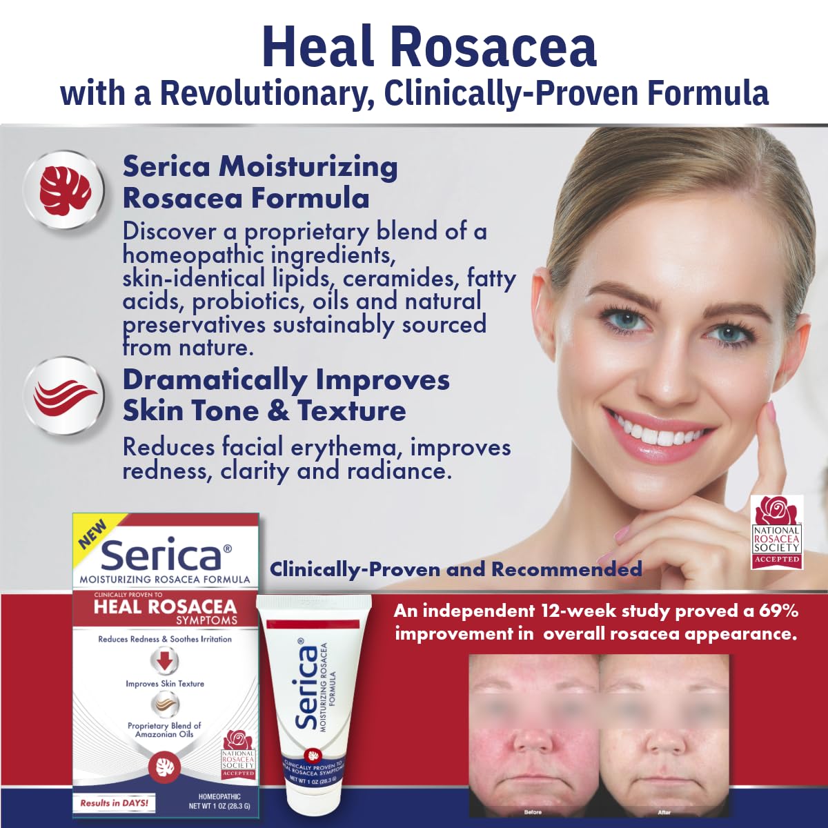 Serica crema rosácea: fórmula aprobada por la Sociedad Nacional de Rosácea