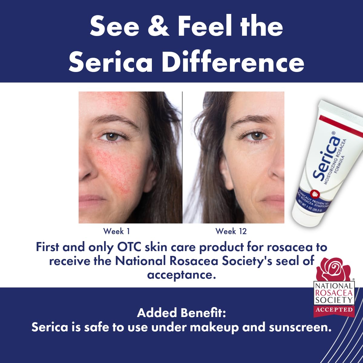 Serica crema rosácea: ceramidas y aceites amazónicos para apoyo suave