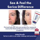 Serica crema rosácea: ceramidas y aceites amazónicos para apoyo suave