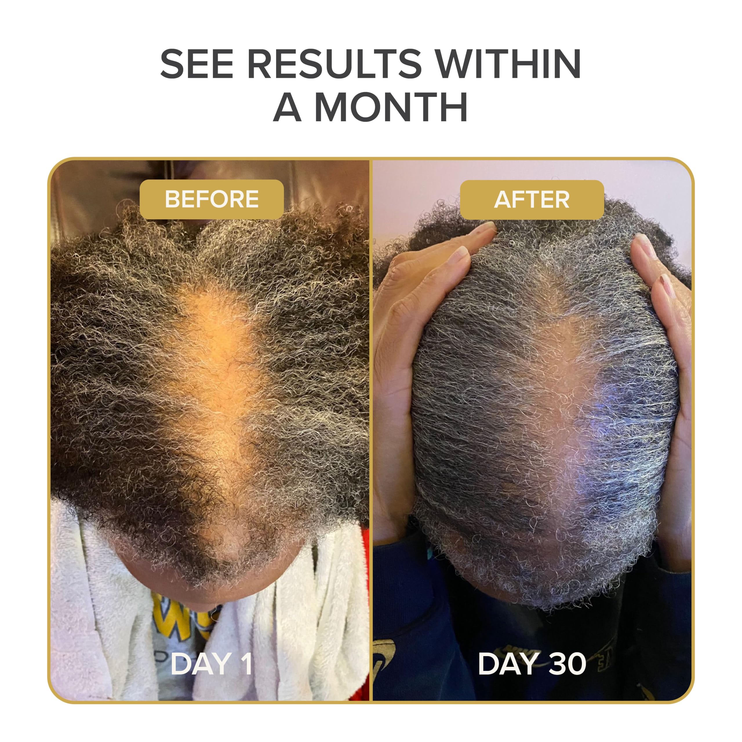 Shedavi Iconico, etiqueta de ingredientes, mezcla natural para cabello saludable