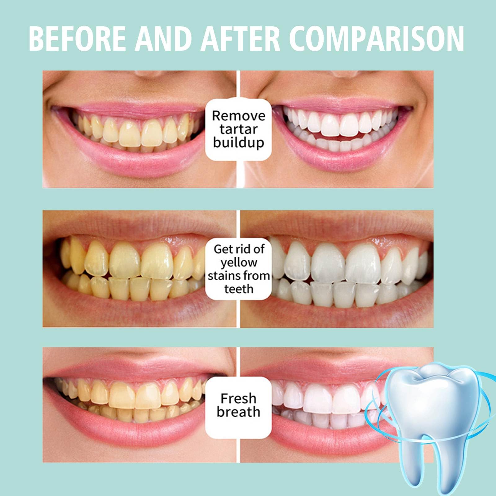 Tecnología de corrección de color de Sheghy para tono de dientes más uniforme.
