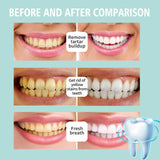 Tecnología de corrección de color de Sheghy para tono de dientes más uniforme.