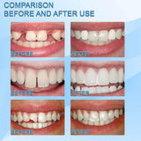SHxxyljh pinzas-dentales de acero inoxidable para manejo preciso