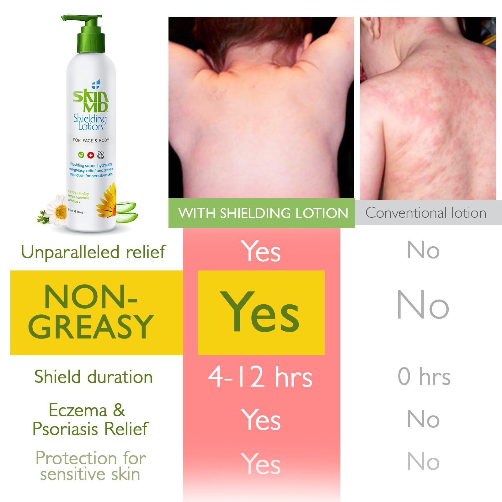 Skin MD Shielding Lotion absorción rápida, piel suave sin residuo graso.