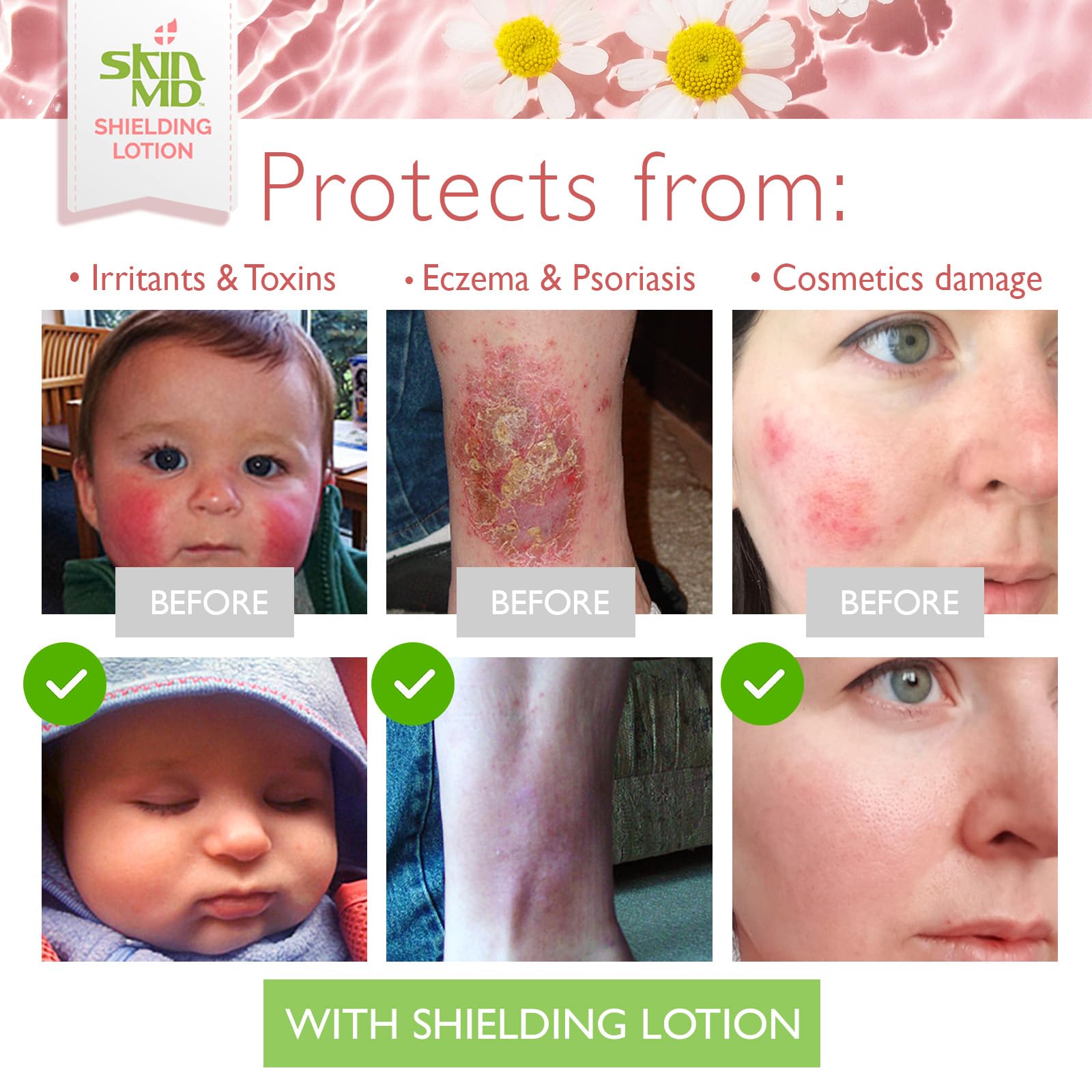 Envase de 8 onzas de Skin MD Shielding Lotion para viajes.