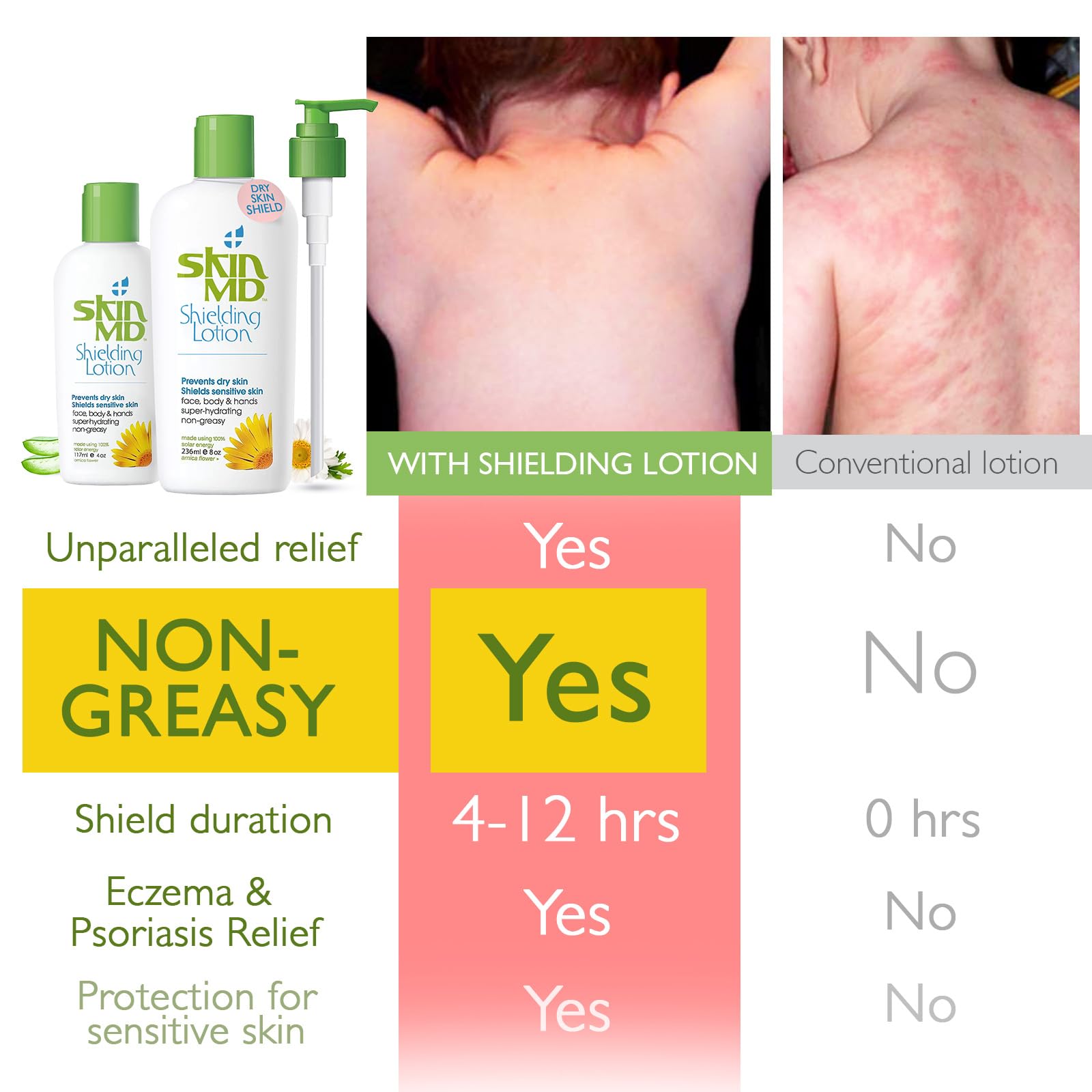 Textura ligera de Skin MD Shielding Lotion sin grasa para uso diario.