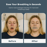 SleepHabits parche nasal para piel sensible, uso cómodo