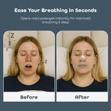 SleepHabits tiras nasales durante la noche para respirar mejor