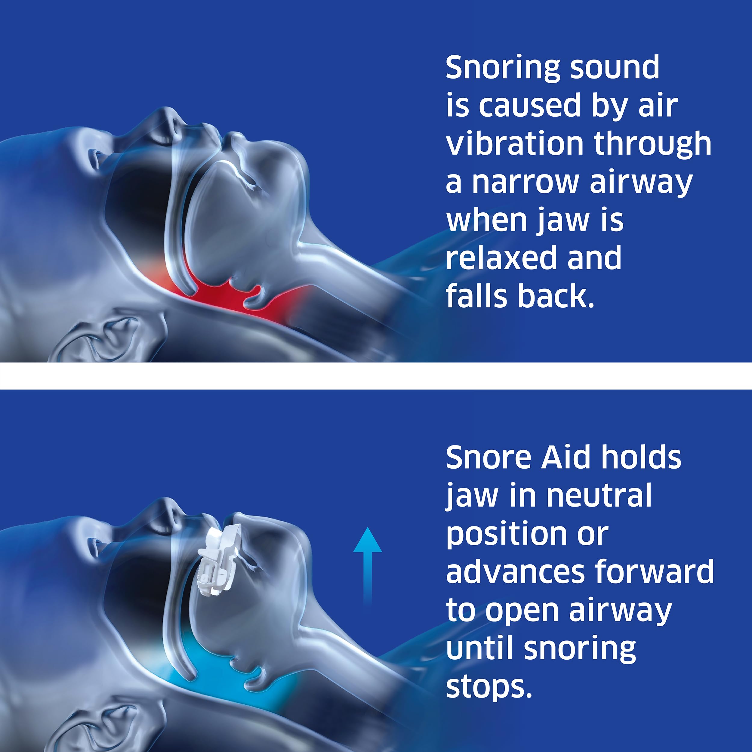 SleepRight Snore Aid Plus ayuda nasal, facilita la respiración durante la noche.