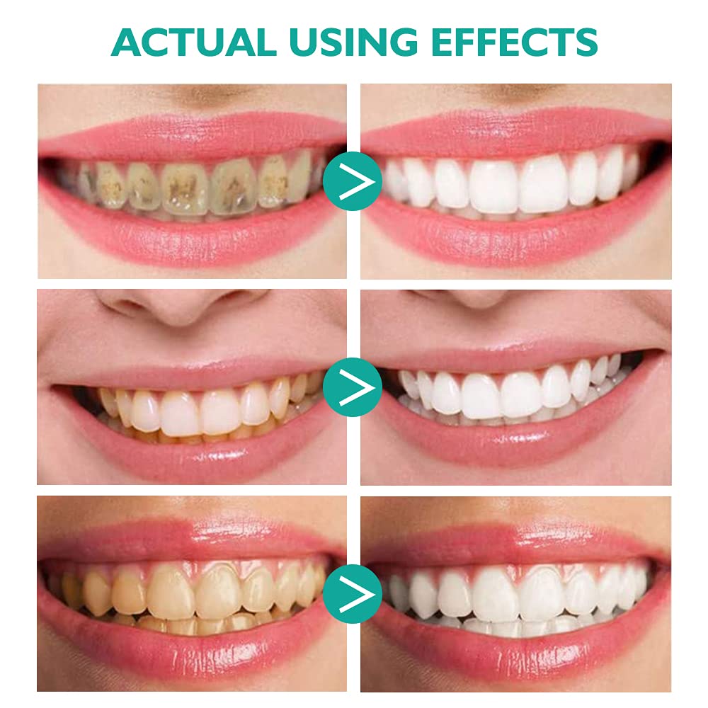 Textura mousse dental Smddx, suave al tacto y refrescante.