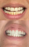 Smile Titan textura del gel blanqueador, sensación suave para uso cómodo