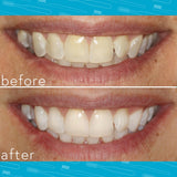 Smileactives diseño-compacto-portatil: cabe en bolso para retoques al instante.
