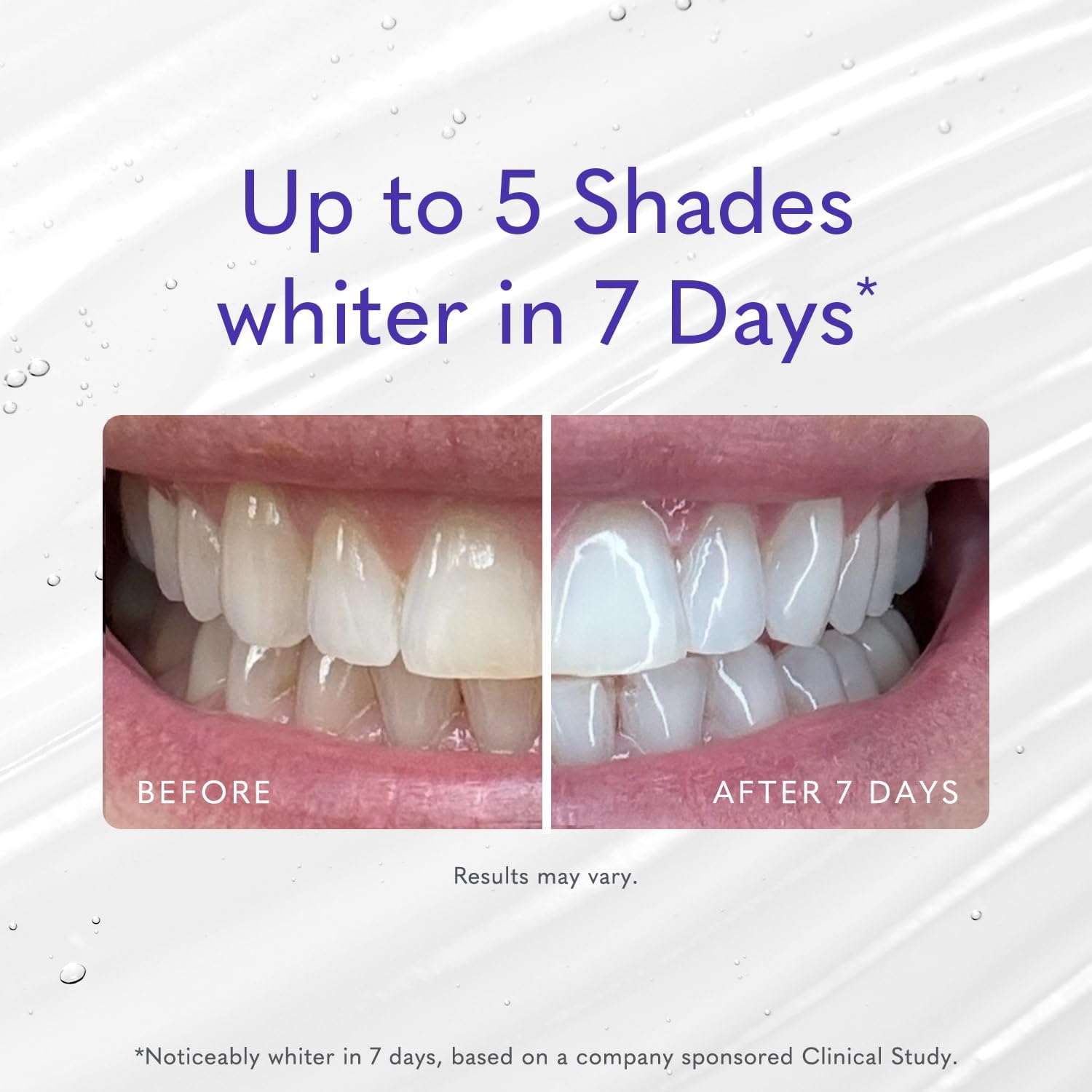 Smileactives gel blanqueador, aplicación diaria: se integra con tu cepillado para resultados consistentes